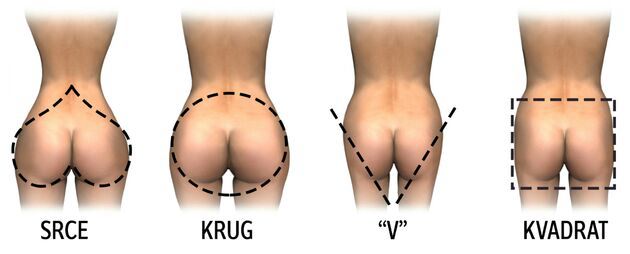 Four types of ass