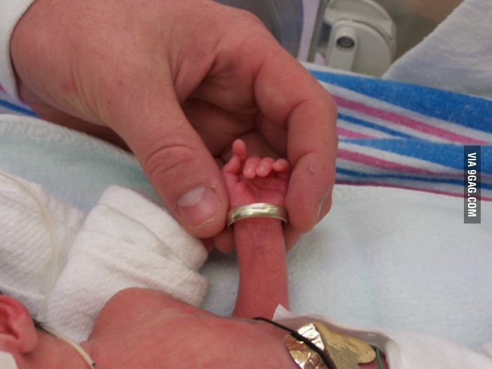 Wedding ring on daughter&#039;s arm