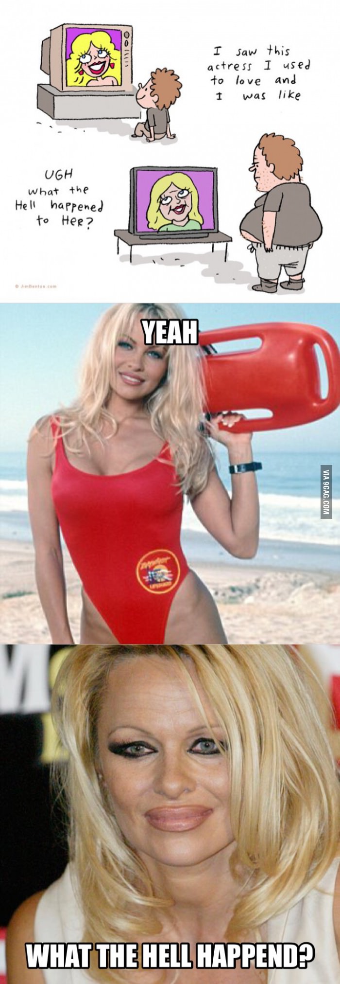 What happend Pamela Anderson?
