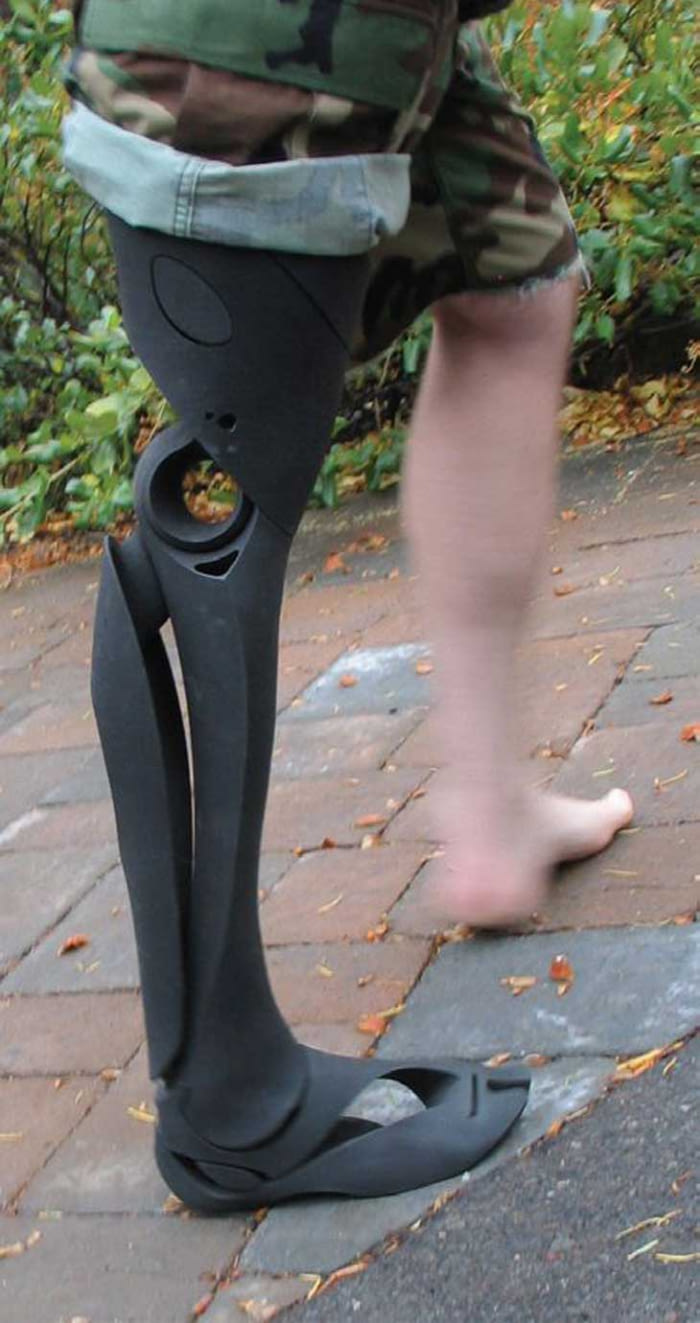 3D printed prosthetic