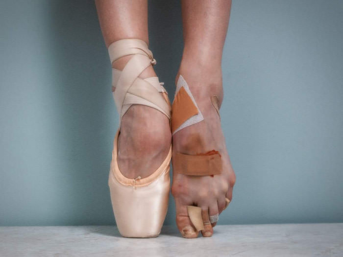 A ballerina&#039;s feet