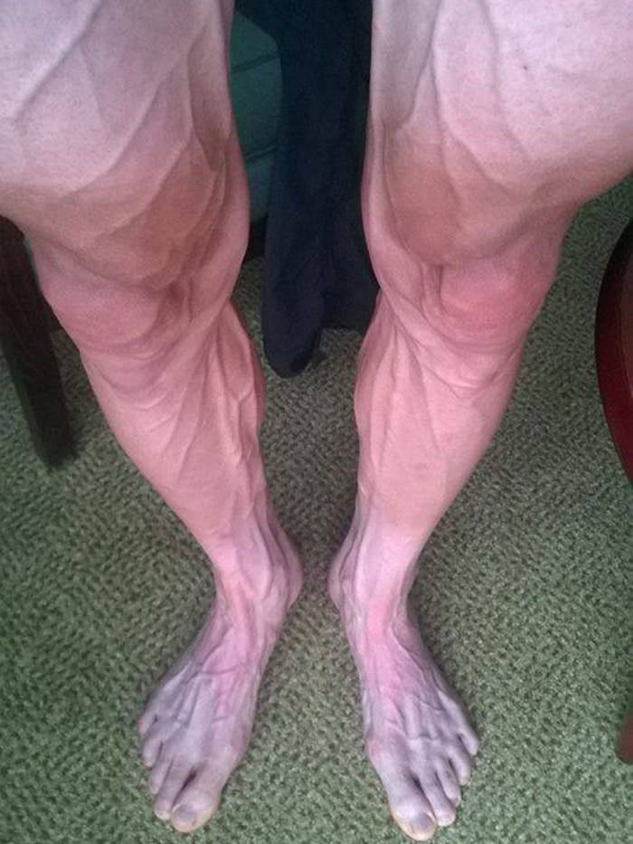 A cyclist&#039;s legs after a stage of the Tour de France