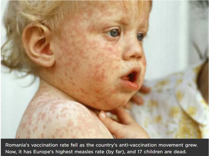 Anti-vaccination movements need to stop now