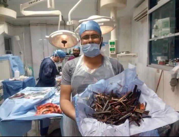 Female patient with psychic disorder . Eating metal tools