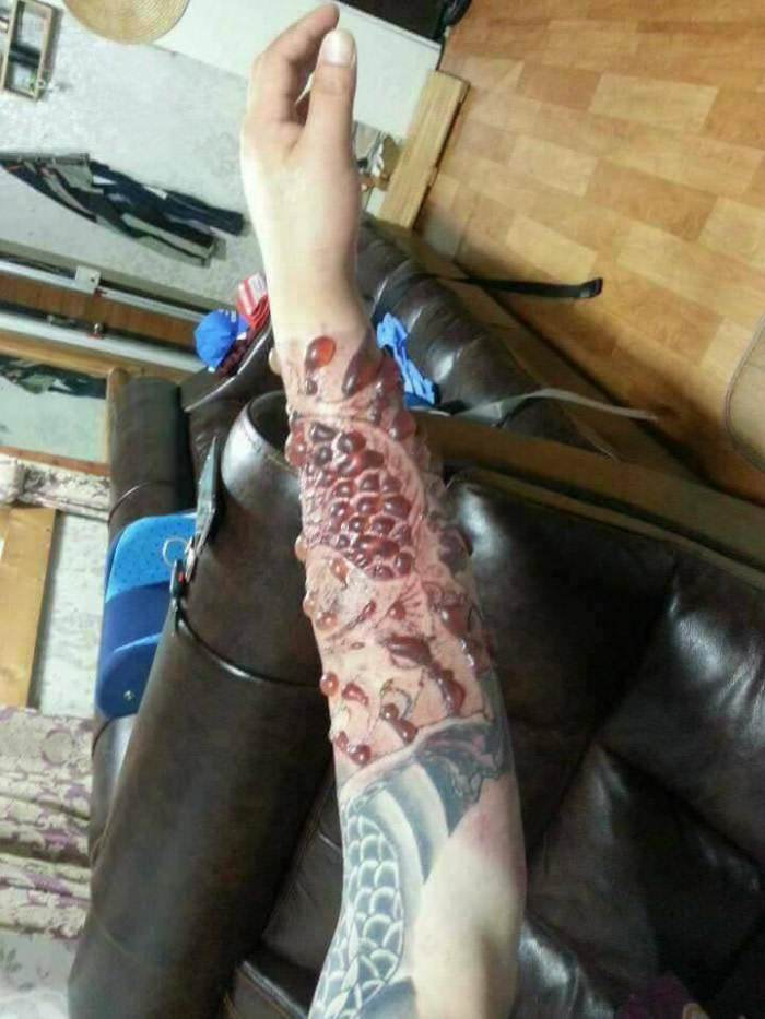 Get tattoo, they said, it would be awesome, they said